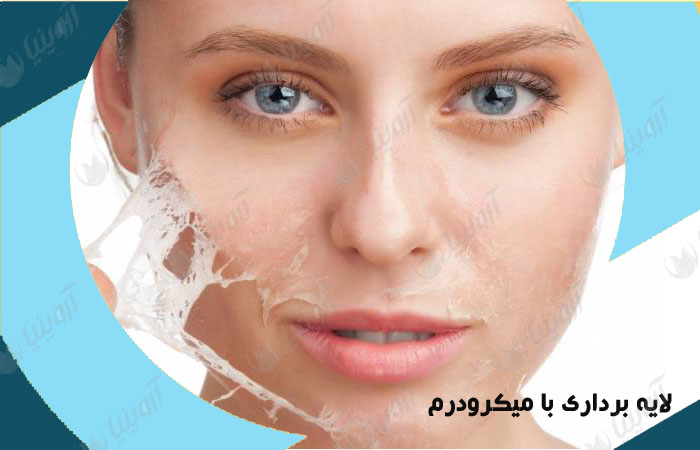 قیمت دستگاه میکرودرم ماهان