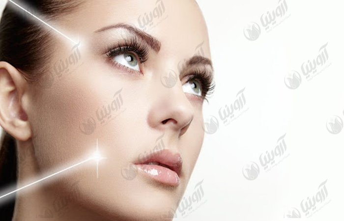 فروش دستگاه کیوسوئیچ لکسو