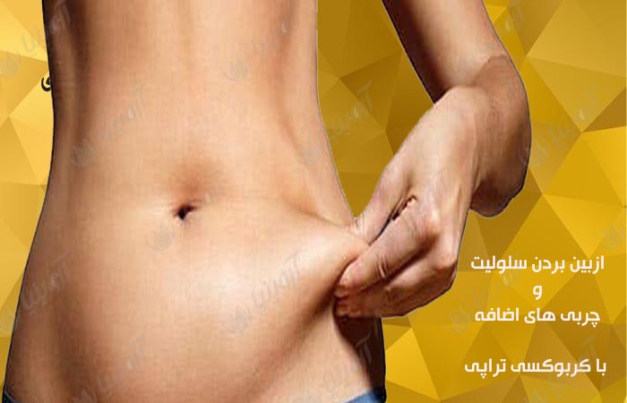 خرید دستگاه کربوکسی زیبایی