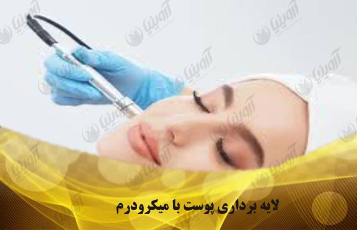 فروش دستگاه میکرودرم آنالوگ
