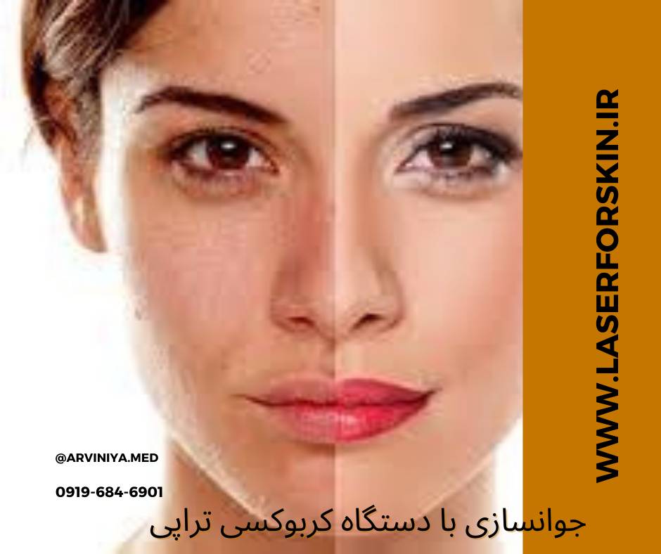 قیمت دستگاه کربوکسی تراپی واژینال