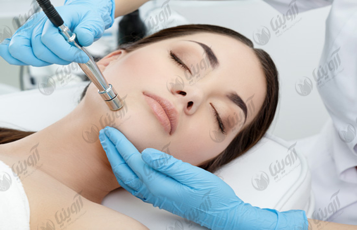 خرید دستگاه میکرودرم ابریژن هاینس