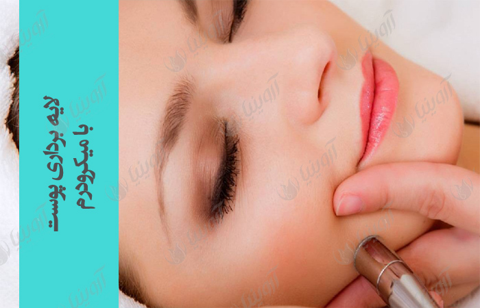 صادرات دستگاه میکرودرم ابریژن پزشکی
