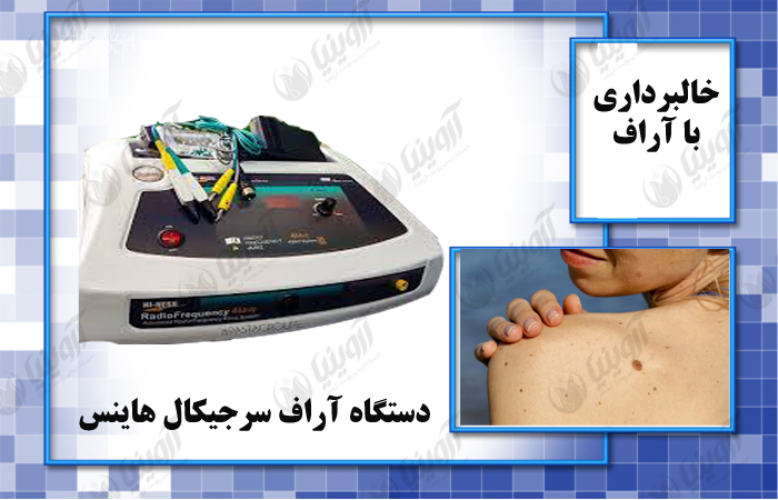 فروش دستگاه آراف خالبرداری