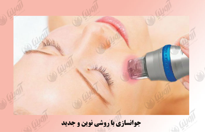 قیمت بهترین دستگاه آر آف فرکشنال صورت