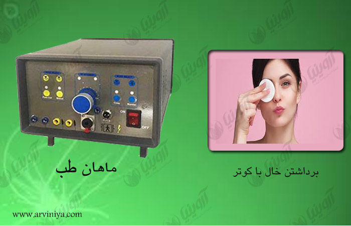 قیمت دستگاه خال برداری
