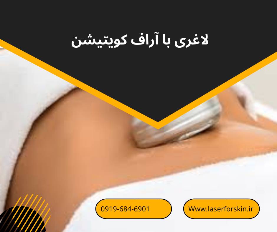 لاغری با دستگاه آراف کویتیشن الینا شیپ
