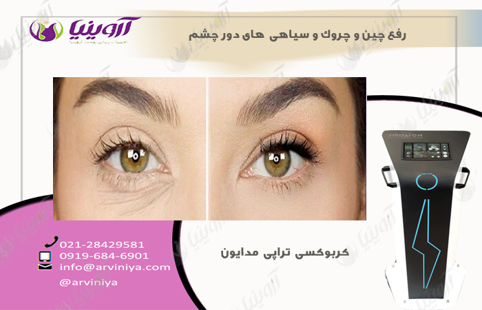 خرید دستگاه کربوکسی تراپی