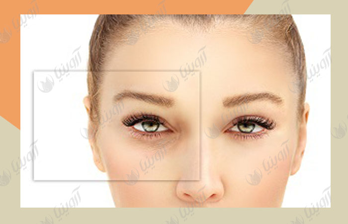 خرید دستگاه میکرودرم پزشکی قیمت مناسب