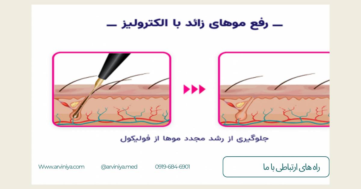 قیمت دستگاه الکترولیز هاینس hiness