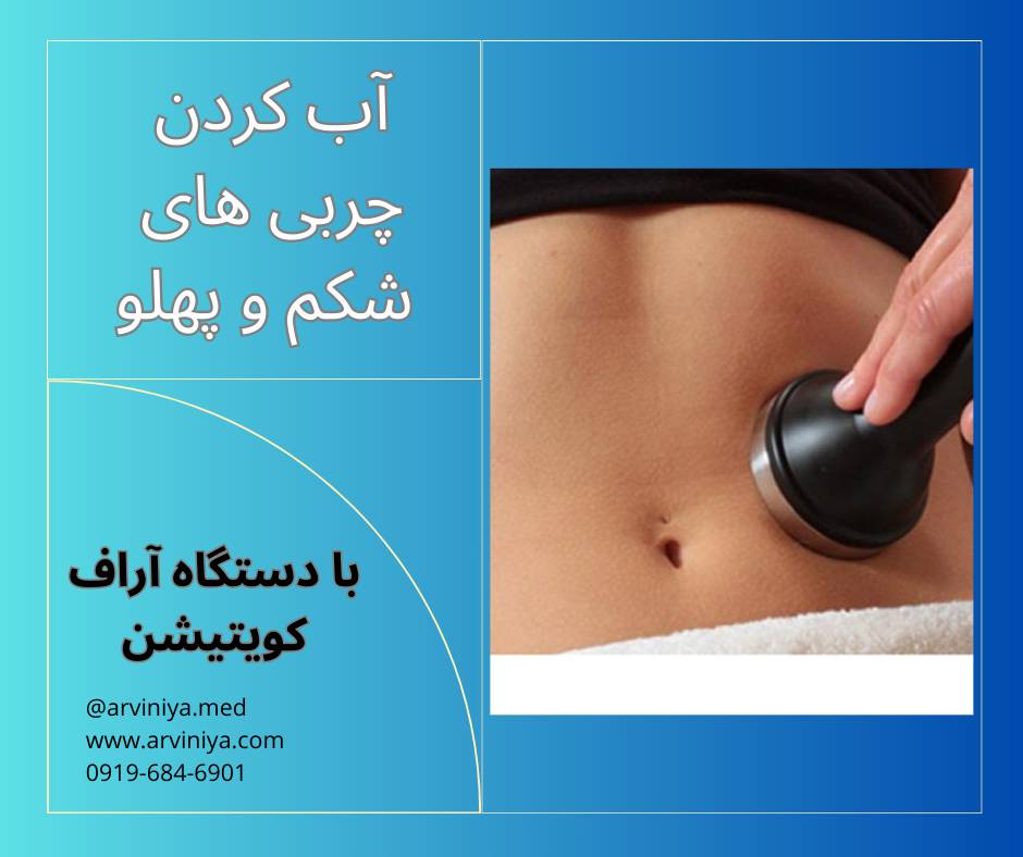 قیمت انواع دستگاه کویتیشن سالنی