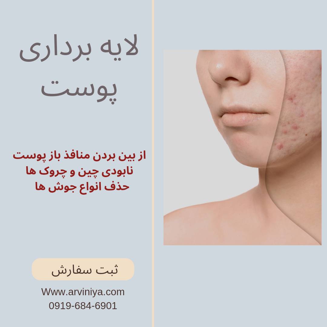 دستگاه پاکسازی پوست میکرودرم ابریژن پزشکی پویان تجهیز