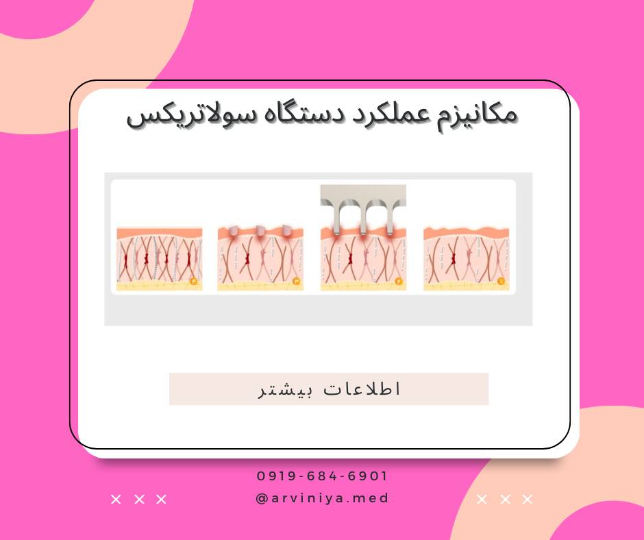 خرید دستگاه ترموفرکشنال سولاتریکس