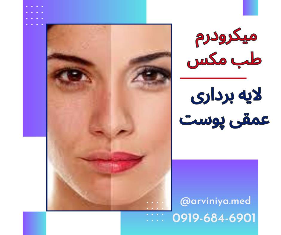 دستگاه میکرودرم ابریژن طب مکس مدل X16