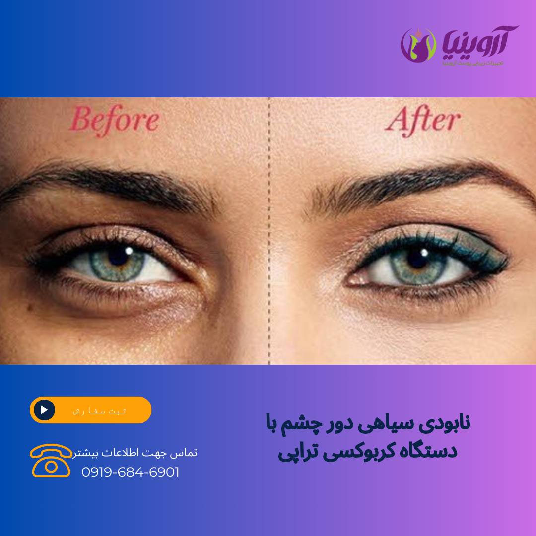سایت فروش دستگاه کربوکسی تراپی