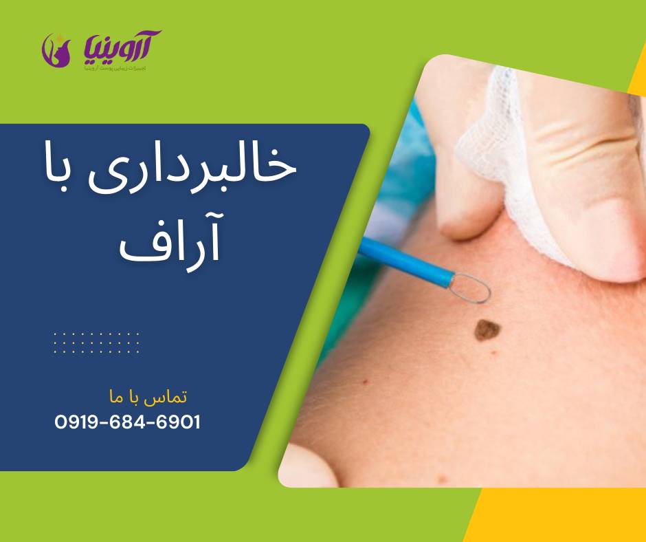 خرید دستگاه آراف کواگوله خالبرداری هاینس انواع مدل ها