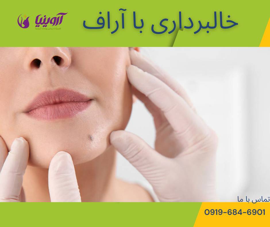 خرید دستگاه آراف کواگوله خالبرداری هاینس انواع مدل ها
