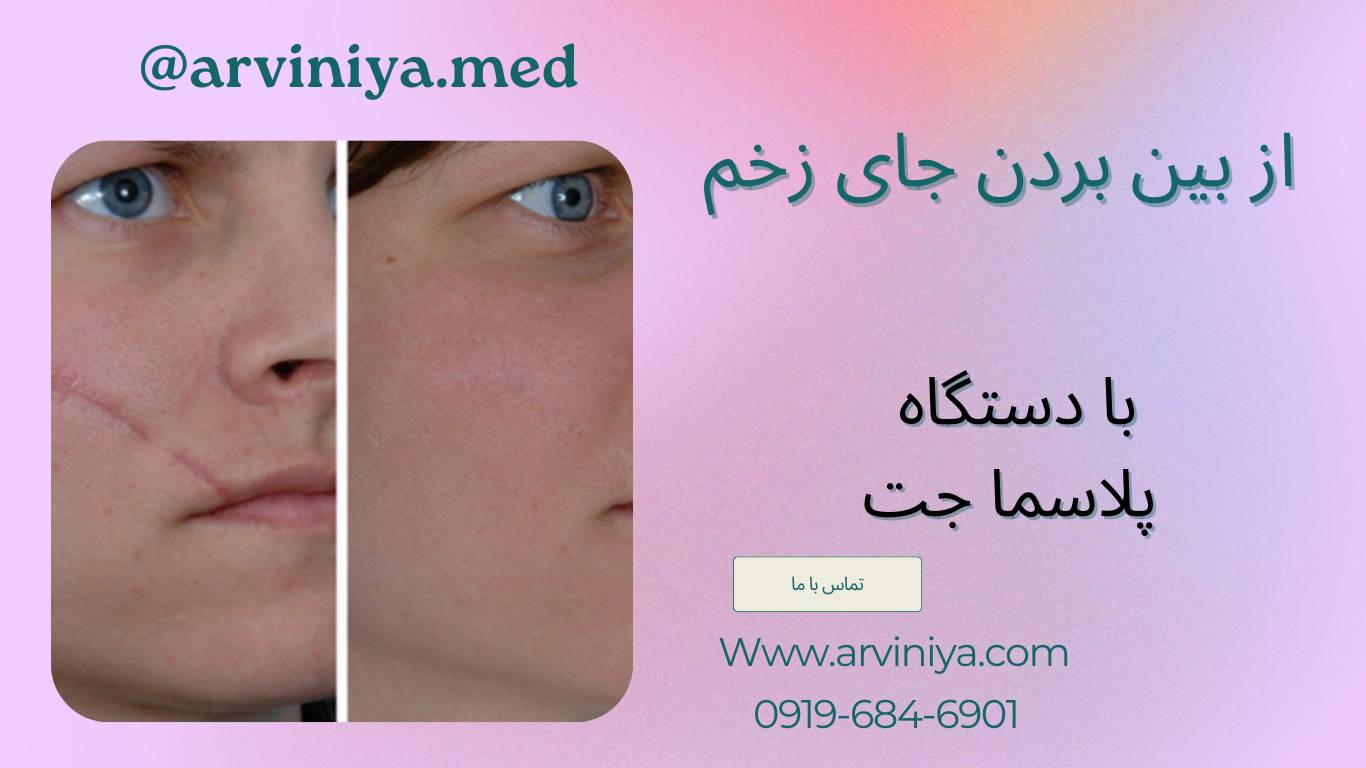 قیمت دستگاه پلاسما جت کلینیکی