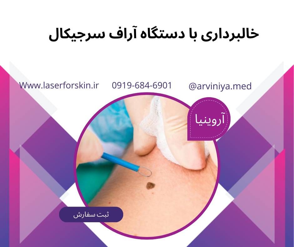 معرفی مدل های دستگاه آر اف سرجیکال خالبرداری
