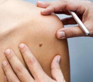 دستگاه های خال برداری