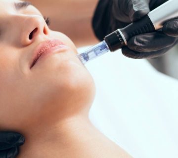دستگاه میکرودرم ابریژن