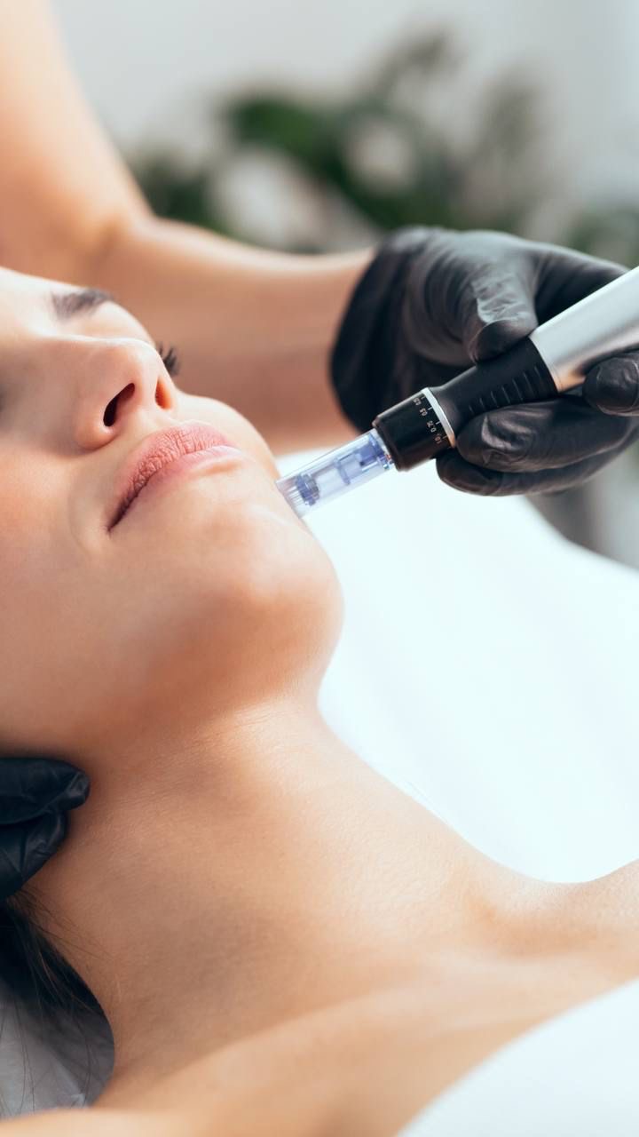 دستگاه میکرودرم ابریژن