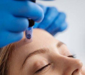 دستگاه میکرودرم ابریژن