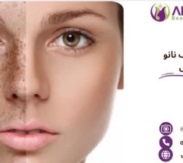 آر اف نانو سرجیکال چیست