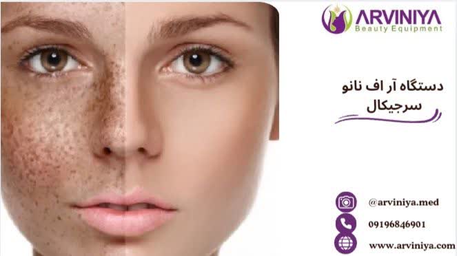 آر اف نانو سرجیکال چیست