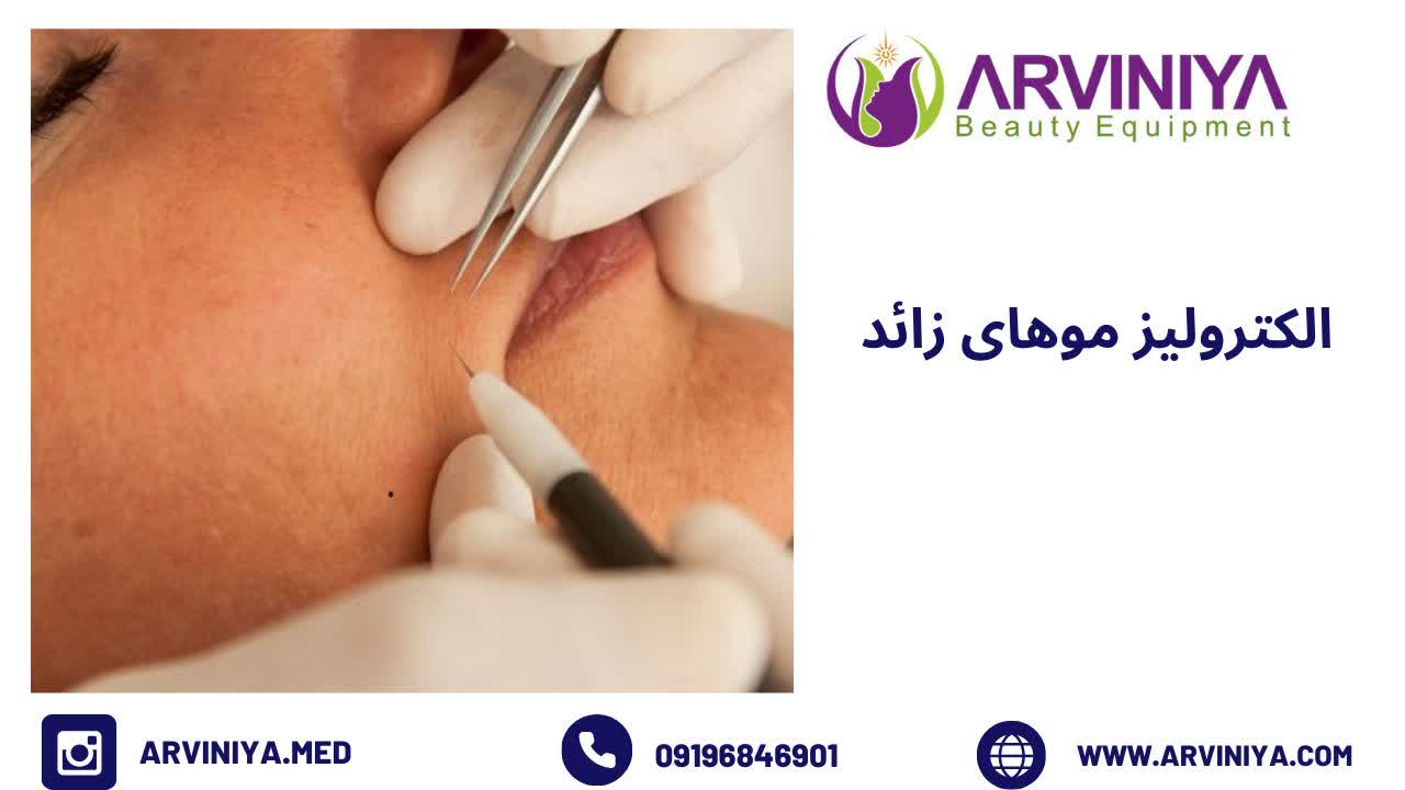 الکترولیز موهای زائد