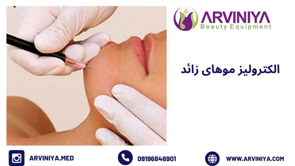 الکترولیز موهای زائد