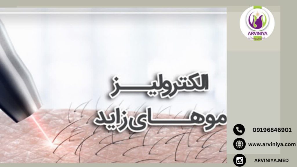نمایندگی فروش دستگاه الکترولیز