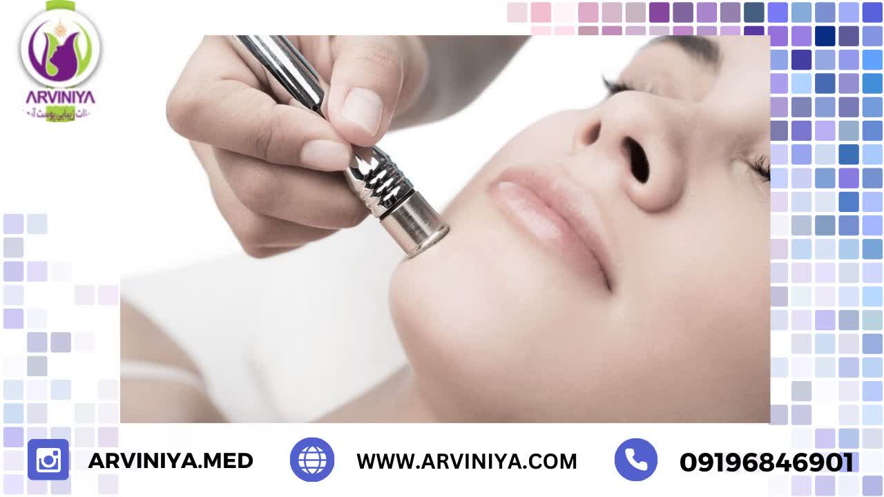 کاربرد دستگاه میکرودرم